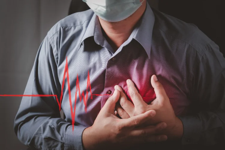 Acute Myocardial Infarction