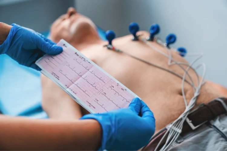Atrial Fibrillation