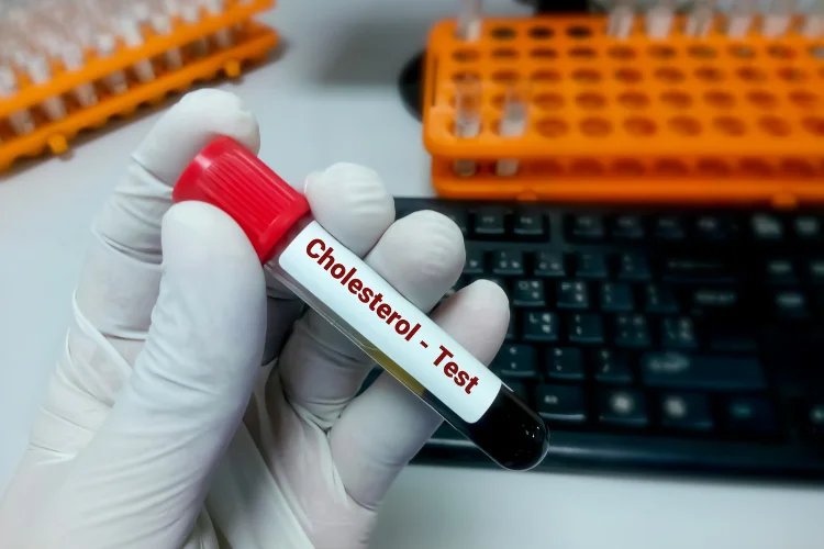 Hypercholesterolemia